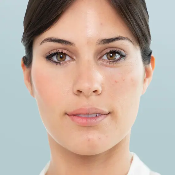 Sauna elektrike për fytyrën Moispa InnovaGoods, 7 imazh